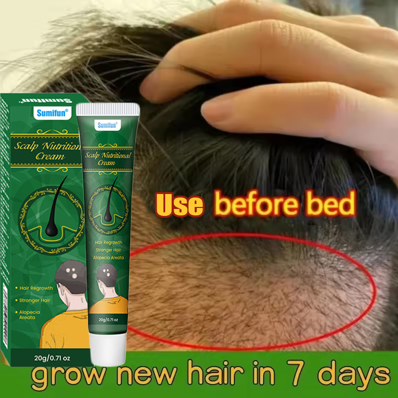 Hair Care Dupes - ครีมเร่งผมยาวสูตรขิง ป้องกันผมร่วง แก้ปัญหาศีรษะล้าน ฟื้นฟูหนังศีรษะที่เสียหาย บำรุงรากผม ผลิตภัณฑ์ดูแลเส้นผม