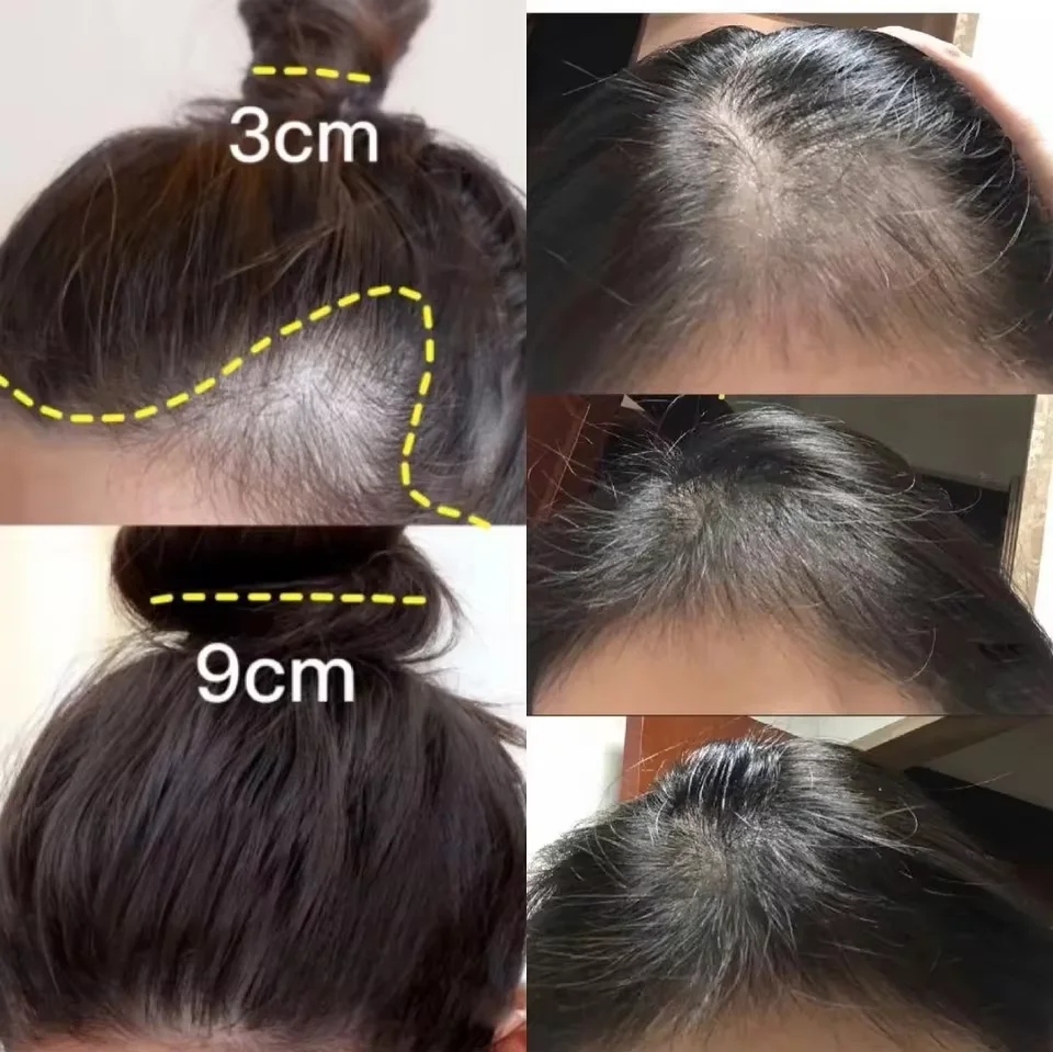 ครีมเร่งผมยาวสูตรขิง ป้องกันผม - Hair Care Dupes บทวิจารณ์และราคา