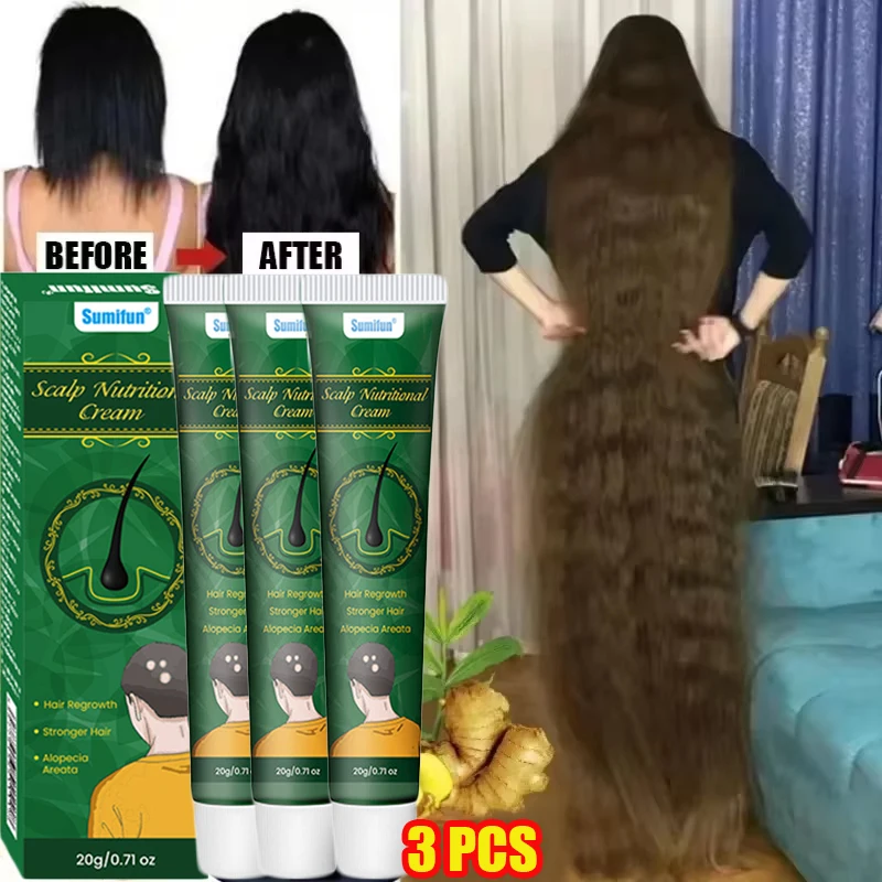 ครีมเร่งผมยาวสูตรขิง ป้องกันผม - Hair Care Dupes บทวิจารณ์และราคา