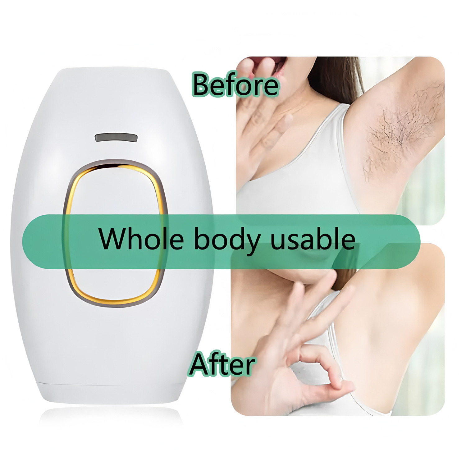 เครื่องกำจัดขนด้วยเลเซอร์แบบมื - From Home Hair Care บทวิจารณ์และราคา