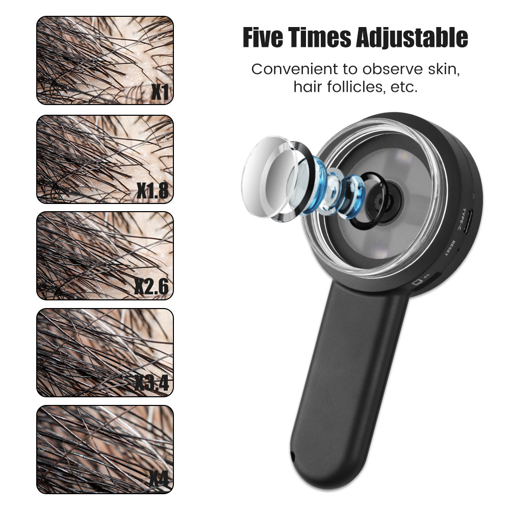 กล้องส่องผิวหนังแบบมือถือ, กำล - Hair Porosity Test บทวิจารณ์และราคา